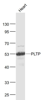 PLTP Rabbit Polyclonal Antibody