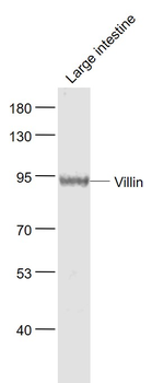 Villin Rabbit Polyclonal Antibody