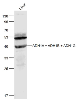 ADH1A + ADH1B + ADH1G Rabbit Polyclonal Antibody