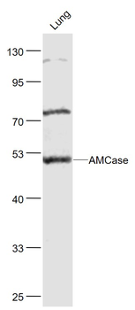 AMCase Rabbit Polyclonal Antibody