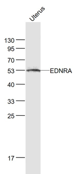 EDNRA Rabbit Polyclonal Antibody