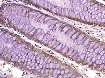 PLK4/STK18 Rabbit Polyclonal Antibody