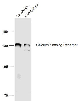 Calcium Sensing Receptor Rabbit Polyclonal Antibody