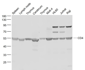 CD4 Rabbit Polyclonal Antibody