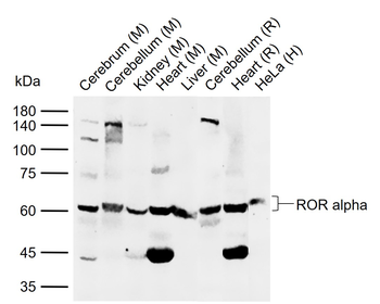 ROR alpha Rabbit Polyclonal Antibody