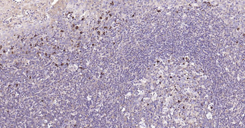 Bax Recombinant Rabbit Monoclonal Antibody