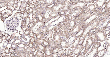 Bax Recombinant Rabbit Monoclonal Antibody