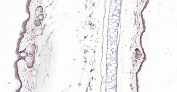 Bax Recombinant Rabbit Monoclonal Antibody