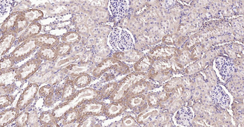 Bax Recombinant Rabbit Monoclonal Antibody