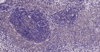 Bax Recombinant Rabbit Monoclonal Antibody