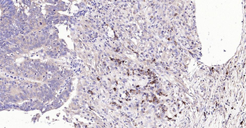 Bax Recombinant Rabbit Monoclonal Antibody