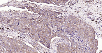 Bax Recombinant Rabbit Monoclonal Antibody