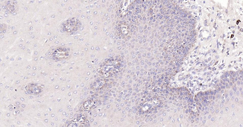 Bax Recombinant Rabbit Monoclonal Antibody