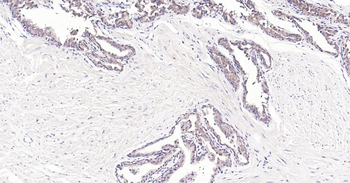 Bax Recombinant Rabbit Monoclonal Antibody