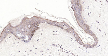 Bax Recombinant Rabbit Monoclonal Antibody