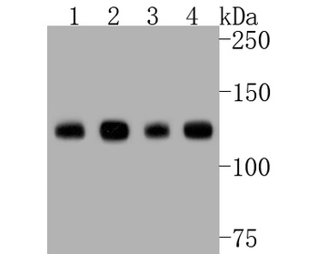 Neuropilin-1 Recombinant Rabbit Monoclonal Antibody