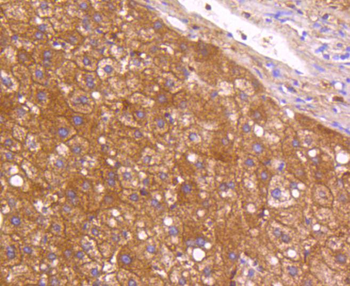 Neuropilin-1 Recombinant Rabbit Monoclonal Antibody