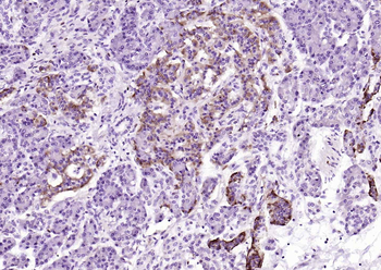 Neuropilin-1 Recombinant Rabbit Monoclonal Antibody
