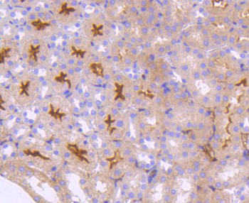 Neuropilin-1 Recombinant Rabbit Monoclonal Antibody