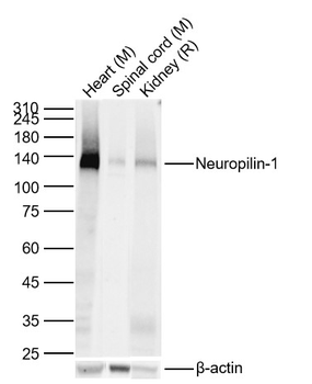 Neuropilin-1 Recombinant Rabbit Monoclonal Antibody