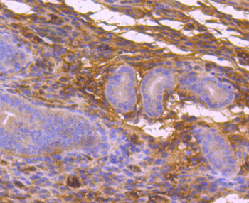 MEKK3 Recombinant Rabbit Monoclonal Antibody