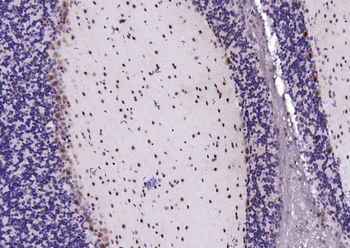 PSMA1 Recombinant Rabbit Monoclonal Antibody