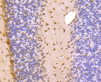 PSMA1 Recombinant Rabbit Monoclonal Antibody