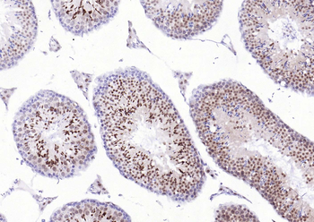 PSMA1 Recombinant Rabbit Monoclonal Antibody
