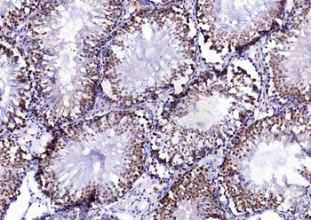 PSMA1 Recombinant Rabbit Monoclonal Antibody