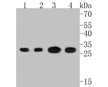 PSMA1 Recombinant Rabbit Monoclonal Antibody