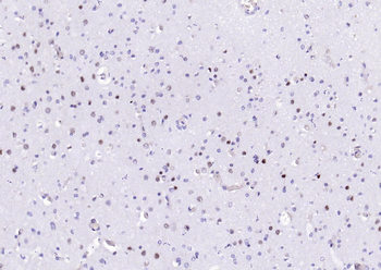 PSMA1 Recombinant Rabbit Monoclonal Antibody
