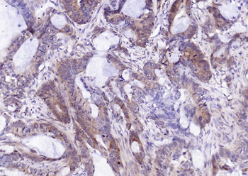 PSMA1 Recombinant Rabbit Monoclonal Antibody