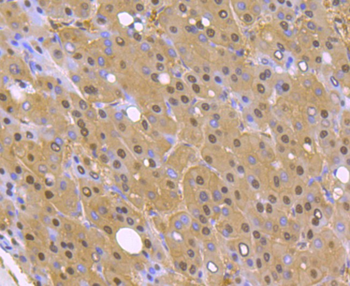PSMA1 Recombinant Rabbit Monoclonal Antibody