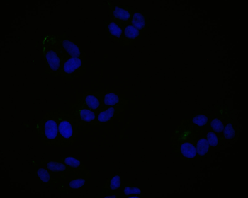 JAK3 Recombinant Rabbit Monoclonal Antibody