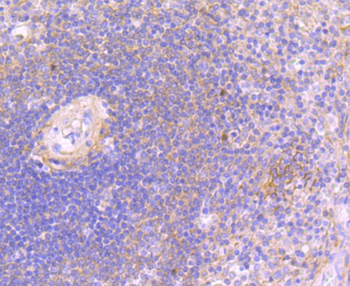 JAK3 Recombinant Rabbit Monoclonal Antibody