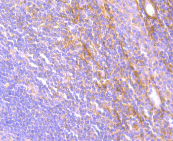 JAK3 Recombinant Rabbit Monoclonal Antibody