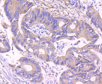 IKK gamma Recombinant Rabbit Monoclonal Antibody