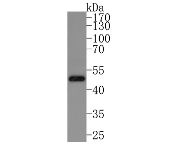 IKK gamma Recombinant Rabbit Monoclonal Antibody