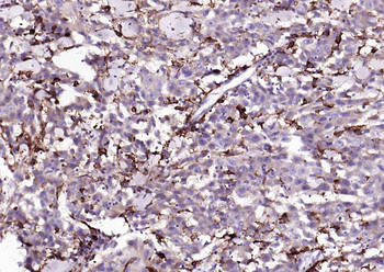 CD14 Recombinant Rabbit Monoclonal Antibody