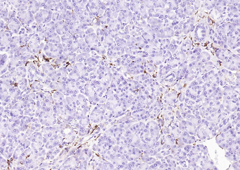 CD14 Recombinant Rabbit Monoclonal Antibody