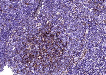 CD14 Recombinant Rabbit Monoclonal Antibody