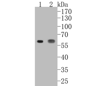 CD14 Recombinant Rabbit Monoclonal Antibody