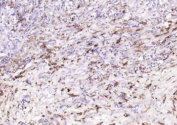 CD14 Recombinant Rabbit Monoclonal Antibody