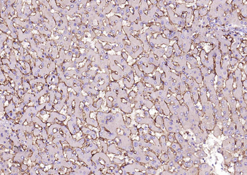 CD14 Recombinant Rabbit Monoclonal Antibody