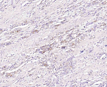 GEF H1 Recombinant Rabbit Monoclonal Antibody