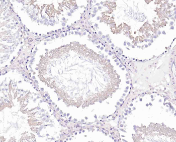 GEF H1 Recombinant Rabbit Monoclonal Antibody