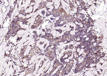 NFKB p65 Recombinant Rabbit Monoclonal Antibody