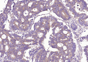 NFKB p65 Recombinant Rabbit Monoclonal Antibody