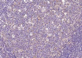 NFKB p65 Recombinant Rabbit Monoclonal Antibody