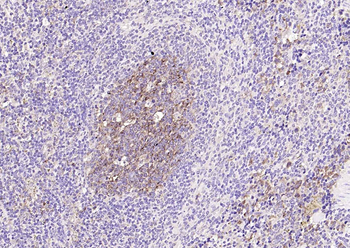 NFKB p65 Recombinant Rabbit Monoclonal Antibody